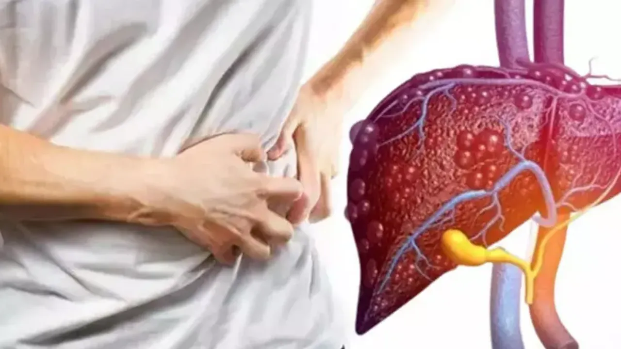 Karaciğerin sinsi tehdidi: Siroz hastalığı ve ölüm riski